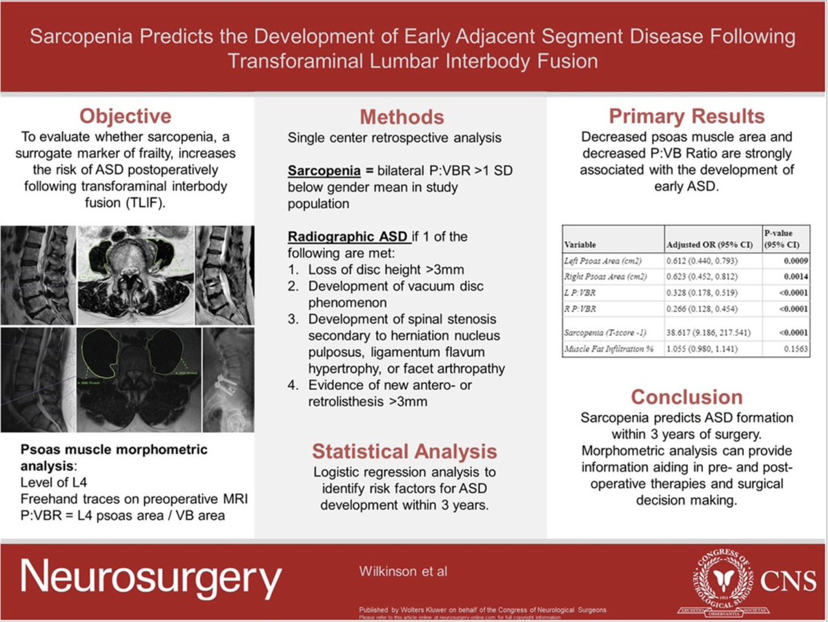 Neurosurgery Publications (@neurosurgerycns) on Twitter photo #NEUVisualAbstract Sarcopenia Predicts the Development of Early Adjacent Segment Disease After Transforaminal Lumbar Interbody Fusion bit.ly/3GVyr95 by Wilkinson et al <a href="/UpstateNews/">Upstate Medical University</a> <a href="/CNS_Update/">CNS</a> <a href="/JohnHShinMD/">John H. Shin MD, MBA</a> <a href="/george_maragkos/">George Maragkos, MD</a> #NEUVisualAbstract Sarcopenia Predicts the Development of Early Adjacent Segment Disease After Transforaminal Lumbar Interbody Fusion bit.ly/3GVyr95 by Wilkinson et al <a href="/UpstateNews/">Upstate Medical University</a> <a href="/CNS_Update/">CNS</a> <a href="/JohnHShinMD/">John H. Shin MD, MBA</a> <a href="/george_maragkos/">George Maragkos, MD</a>