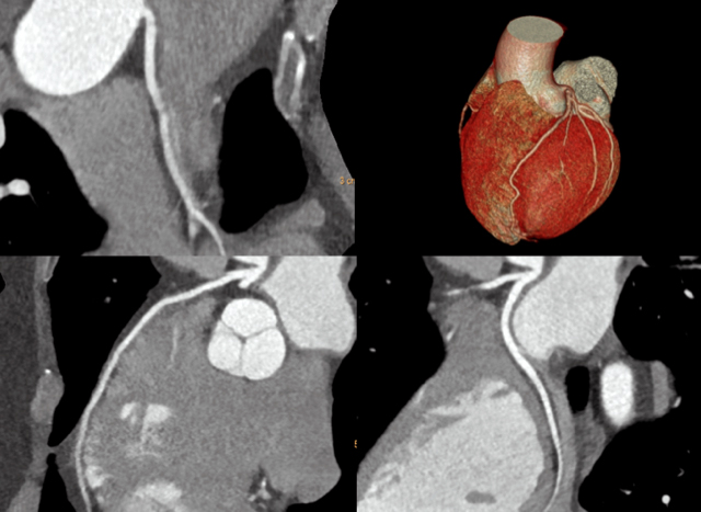 Kardiologie heute – Entwicklungen der 2020er
Die aktuelle Dekade steht im Zeichen der digitalen und molekularen Medizin.

 kardiologie-baden-baden.de/presseinfos/vo…
#ZukunftDerKardiologie #DigitaleMedizin #PersonalisierteTherapie #Telemedizin #Herzmedizin