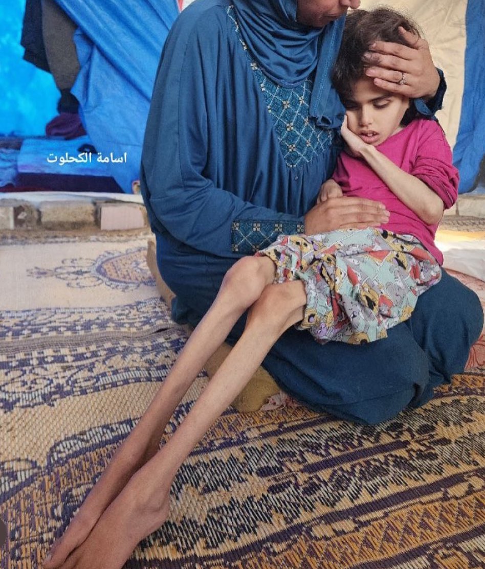 غزة تُقصف تُجوع تُحاصر والعالم كأن شيئًا لم يكن!! يُقتل الأطفالها تُهدم البيوت ولا أحد يتحرك بل لا أحد جرب أن يتحرك

اللهم نبرأ إليك من خذلان إخواننا في غزة
نبرأ إليك من صمتنا ومن عجزنا ومن تقصيرنا المتكرر.