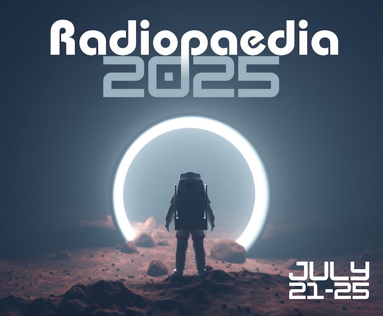 Radiopaedia is a quiet revolution. 

It broke the walls of access and cost and built a living library—open, free, evolving, and alive.
By radiologists. 
For radiologists.
And for every curious mind.

Grateful to be part of a community,
Where sharing knowledge is not an