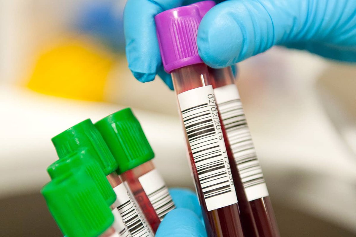 Le #CRB-CHU Angers met à disposition des échantillons biologiques humains pour la recherche en #santé ➡️ ibisa.net/annuaire-crb/c… <a href="/chu_angers/">CHU Angers</a> <a href="/uroccr/">UroCCR</a>