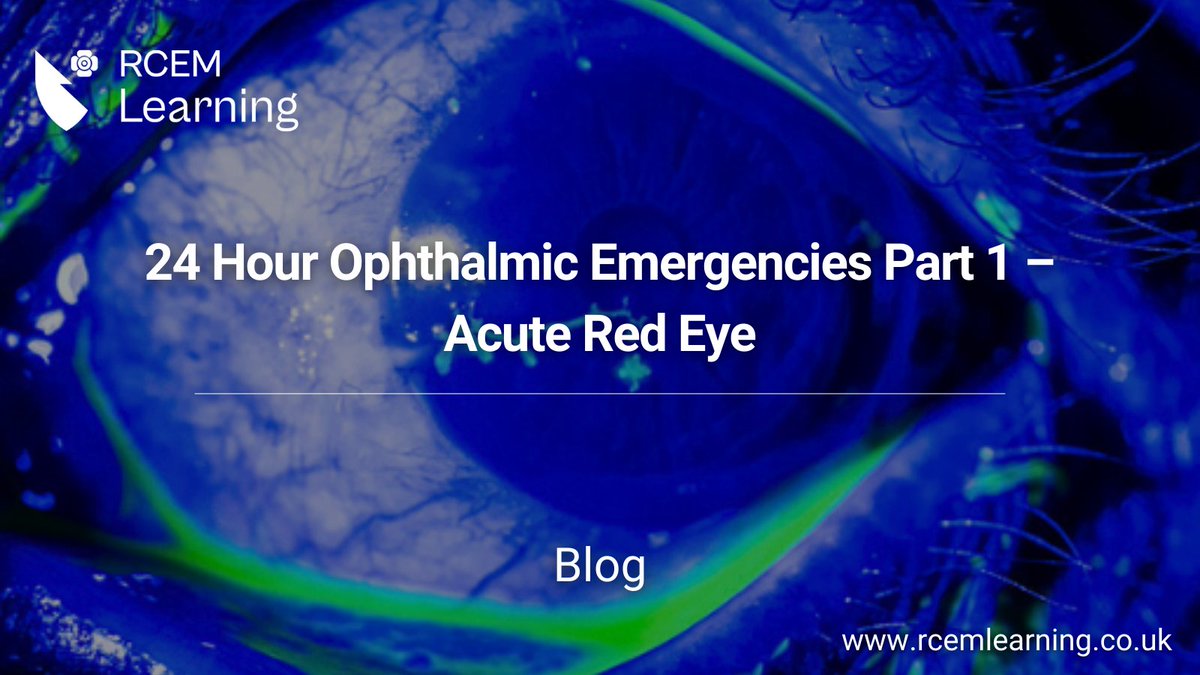 NEW: This #blog summarises the assessment and initial management of common ophthalmic emergency presentation such as the acute red eye.

The first in a four part series: rcemlearning.co.uk/foamed/24-hour…