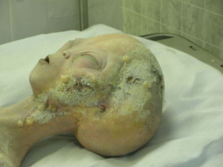 "Como um lembrete: a imagem incluída nesse arquivo aparenta ser irreal apenas como um resultado dessa anomalia e é, de fato, um arquivo fotográfico genuíno da Fundação."

👽 SCP-2345 — "Anatomia Gray", escrito por Lowell, traduzido por Sr Editor.

scp-pt-br.wikidot.com/scp-2345