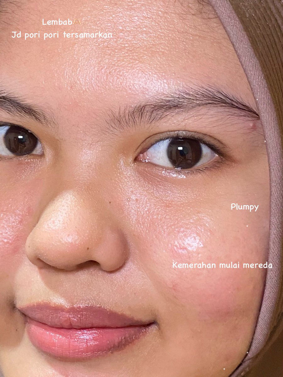 lalavyy's tweet photo. Mau kasi apresiasi untuk skincare lokal ini… bkin kulit aku awalnya rewel jd mendingan bgt 😭🙏🏻 https://t.co/rJZupLJCLx