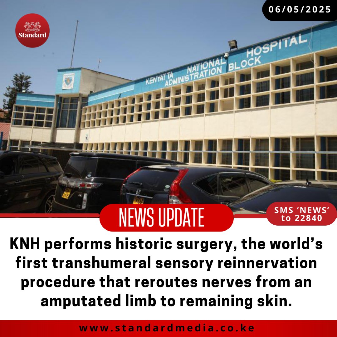 StandardKenya's tweet photo. KNH performs historic surgery, the world’s first transhumeral sensory reinnervation procedure that reroutes nerves from an amputated limb to remaining skin. https://t.co/xb59DqXZ0N