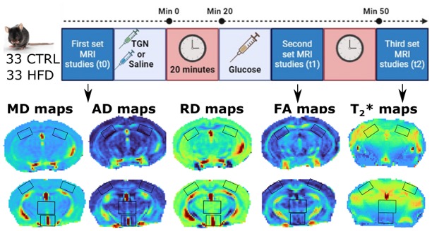 Happy to share the group's latest publication in Scientific Reports!: Aquaporin-4 inhibition alters
cerebral glucose dynamics
predominantly in obese animals: an
MRI study.
nature.com/articles/s4159…