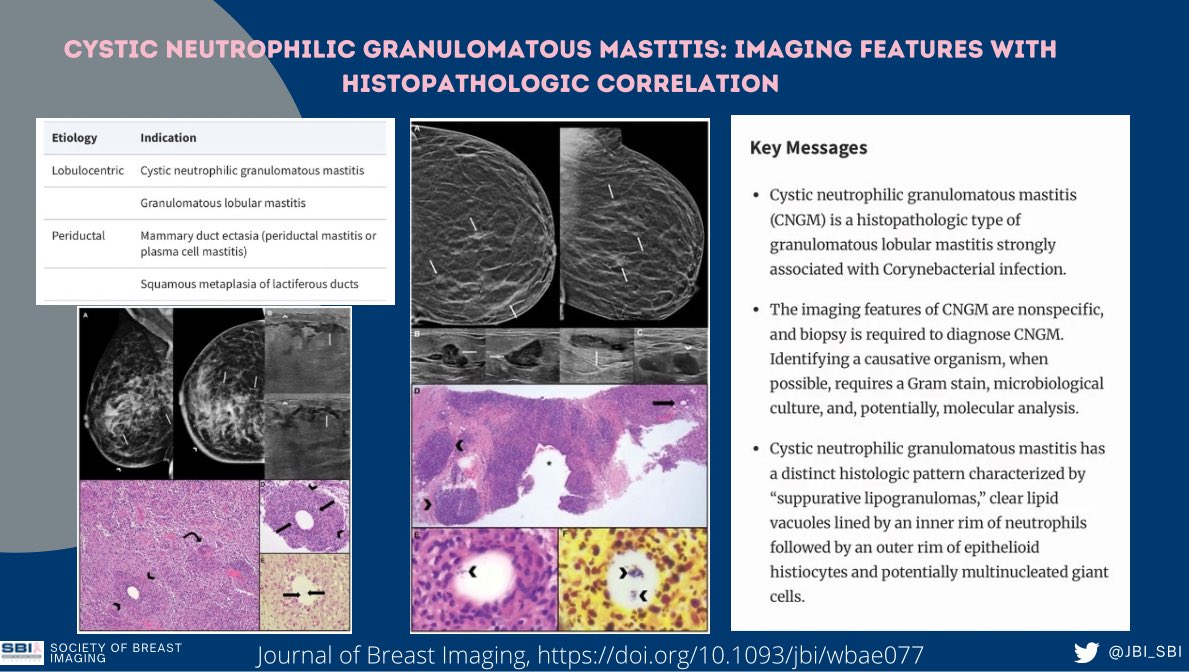 📣📣JBI #RAD-PATH CORRELATION📣📣

✨CNGM: Rare cause of granulomatous mastitis; distinct histopathologic pattern. ✨Imaging appearance: less well described in lit, nonspecific 
✨Lab: microbiology lab for culture studies

Read more: 

📩 doi.org/10.1093/jbi/wb…