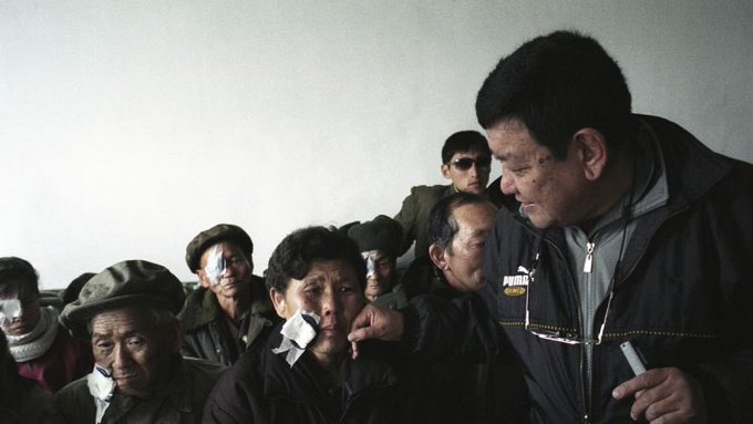 LonggAgo's tweet image. Dr. Sanduk Ruit, a famous eye doctor from Nepal, has changed many lives by doing cataract surgeries for over 100,000 people, mostly poor folks from far-off places. He does these surgeries for free or very cheaply, using a special, affordable method that lets him help lots of…