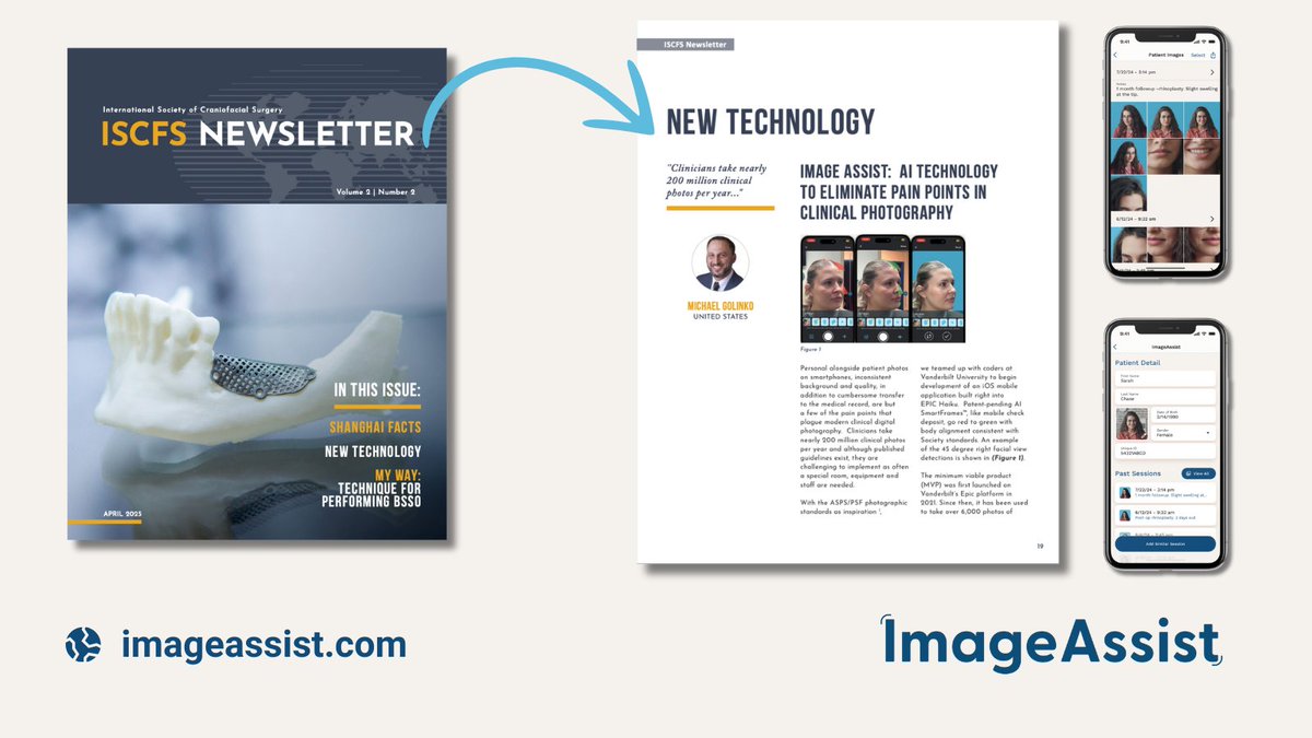 ImageAssist (@imageassist) on Twitter photo 📰 Just featured in the April <a href="/iscfs_society/">International Society of Craniofacial Surgery</a> newsletter!
ImageAssist is raising the bar for clinical photography with SmartFrames, seamless workflows & secure storage.
Built by surgeons, for surgeons. 📰 Just featured in the April <a href="/iscfs_society/">International Society of Craniofacial Surgery</a> newsletter!
ImageAssist is raising the bar for clinical photography with SmartFrames, seamless workflows & secure storage.
Built by surgeons, for surgeons.