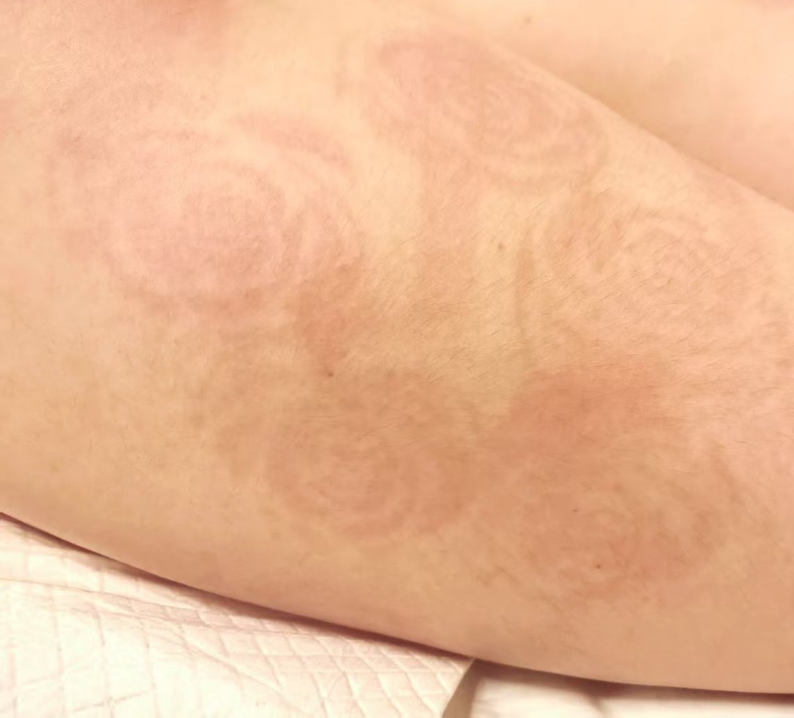 真的超级喜欢印花哇～～～
（虽然但是归姐搞偷袭～）
<a href="/wukegenggai/">殊途同归</a> 
#重庆 #小圈聚会 #印花