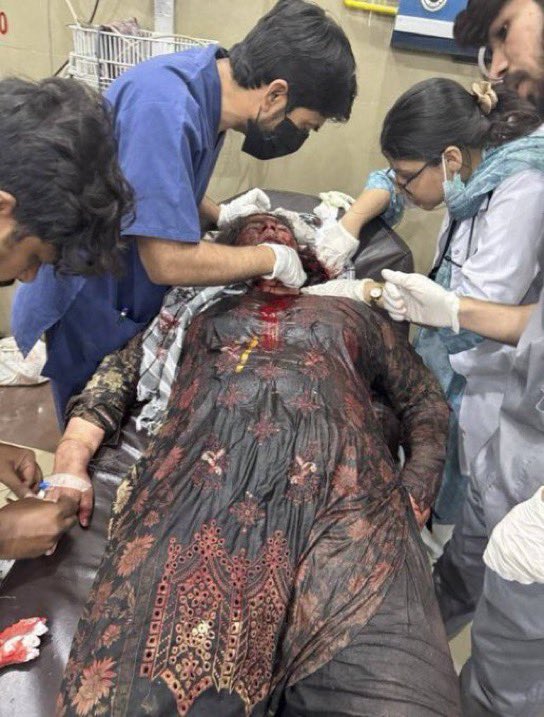 jacksonhinkle's tweet photo. 💔🇵🇰 BREAKING: The aftermath of INDIA’S BOMBING on PAKISTANI CIVILIANS. https://t.co/wRVwzm9WNj