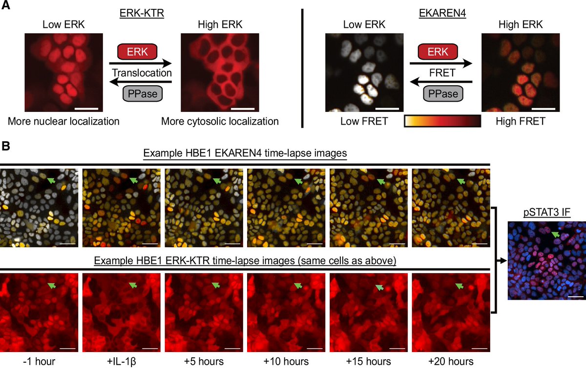 ATS Red Journal (@ajrcmb) on Twitter photo Spatiotemporal Clusters of Extracellular Signal-Regulated Kinase Activity Coordinate Cytokine-induced Inflammatory Responses in Human Airway Epithelial Cells
<a href="/atscommunity/">American Thoracic Society (ATS)</a>
🔗 atsjournals.org/doi/full/10.11… Spatiotemporal Clusters of Extracellular Signal-Regulated Kinase Activity Coordinate Cytokine-induced Inflammatory Responses in Human Airway Epithelial Cells
<a href="/atscommunity/">American Thoracic Society (ATS)</a>
🔗 atsjournals.org/doi/full/10.11…