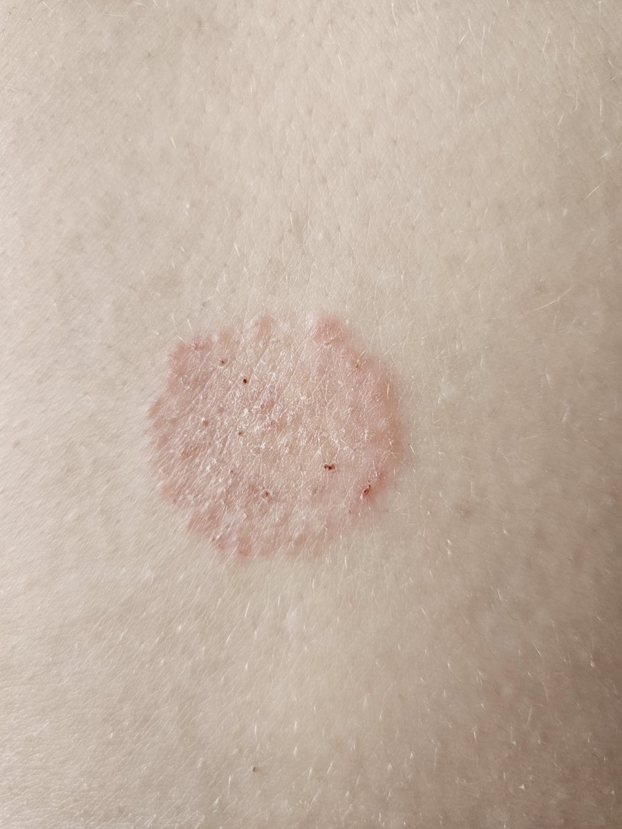 Keith Siau tweet media