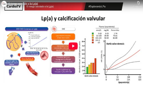 CardioTeca (@cardioteca) on Twitter photo 🎥 El riesgo asociado a la Lp(a)
👀 cardioteca.com/videos/video-l…
CardioTV de la <a href="/secardiologia/">Soc Esp Cardiología</a> 🎥 El riesgo asociado a la Lp(a)
👀 cardioteca.com/videos/video-l…
CardioTV de la <a href="/secardiologia/">Soc Esp Cardiología</a>