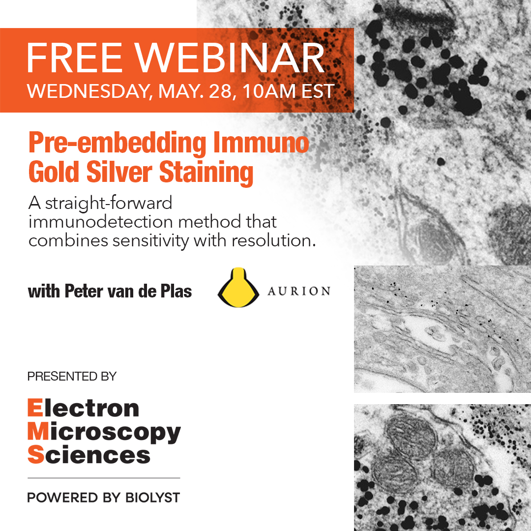 Don't miss it:
• The advantages and limitations of IGSS.
• Tips and tricks to optimize the general incubation protocol.
5/28/25, 10:00 AM (ET)
Speaker: Peter van de Plas

Register now: bit.ly/44lDY2A
#EMShasit #microscopy #microtomy #Aurion #immunogold