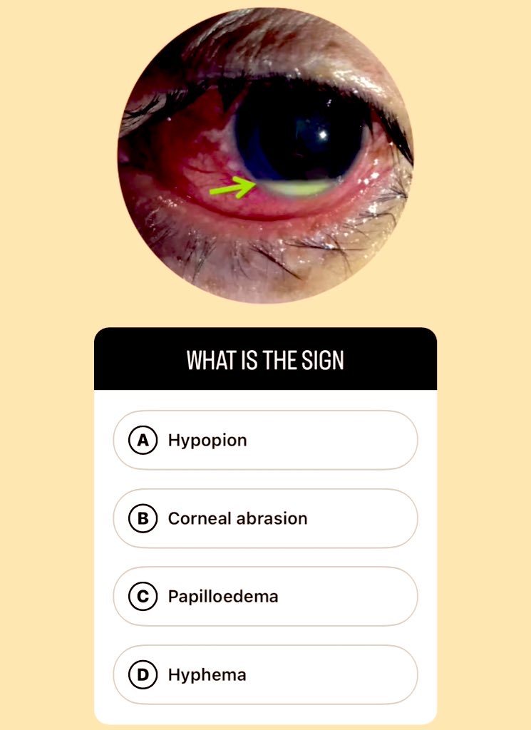 WHAT IS THE SIGN