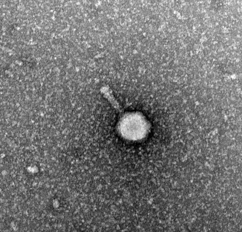 JPUR (@researchpurdue) on Twitter photo Students in Dr. Kari Clase’s lab investigate the structure and genome of a bacteriophage recently discovered on Purdue’s campus, the PurduePete mycobacteriophage. Read more in the 2024 edition of JPUR - docs.lib.purdue.edu/jpur/vol14/iss… Students in Dr. Kari Clase’s lab investigate the structure and genome of a bacteriophage recently discovered on Purdue’s campus, the PurduePete mycobacteriophage. Read more in the 2024 edition of JPUR - docs.lib.purdue.edu/jpur/vol14/iss…