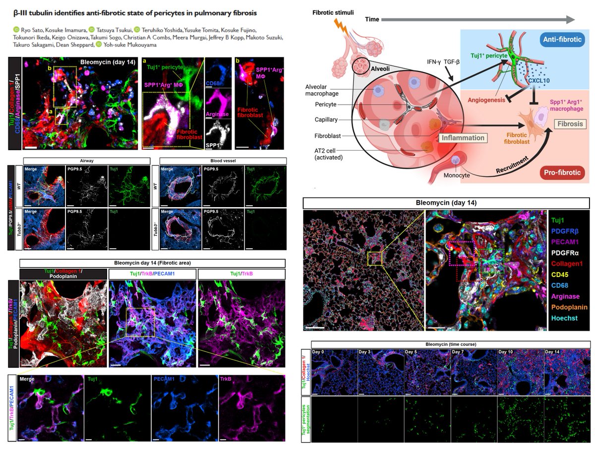 Lung #Pericyte #Fibrosis

Tuj1/βIIITub+ Pericyte expands in #Bleomyin-induced mouse #PulmonaryFibrosis

A potential anti-fibrotic #Pericrine CXCL10

Not Collagen-depositing

Tubb3 KO🐭➡️exacerbated fibrosis

#SciArt
Yoh-suke Mukouyama lab bioRxiv 2025
biorxiv.org/content/10.110…