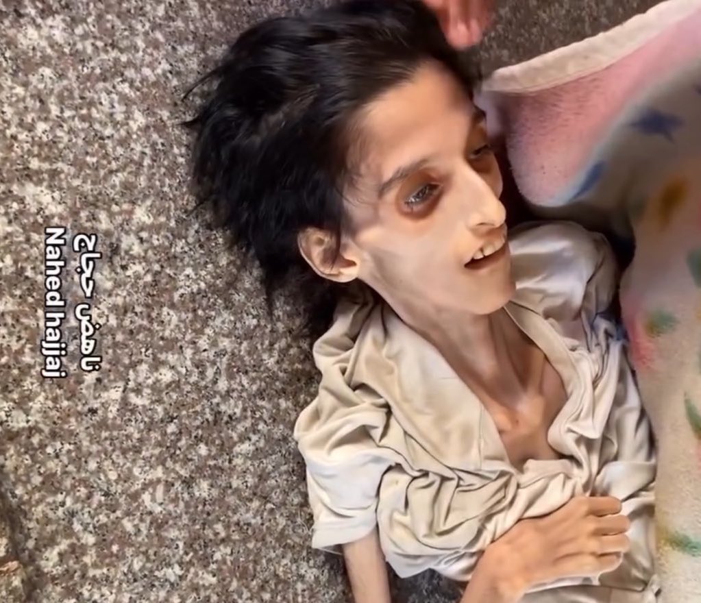 Gaza is starving. 

Are you still with us ? Do you hear us !
Reply with 🇵🇸 if you see this pic, pass it ...