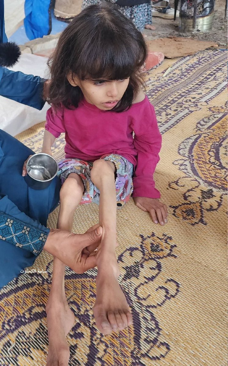 Sözde İslam ülkelerinin terkettiği Gazze’de çocukların hali.