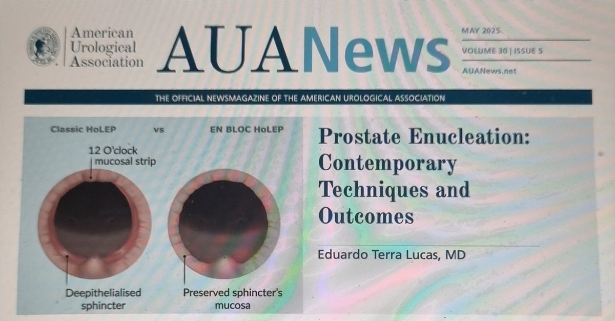 Eduardo Terra Lucas (@terralucas1) on Twitter photo Invite all to ready the article just published at #AUANews about modern outcomes of #HoLEP. It's an honor to make the cover of such a prestigious journal from a issue that I really dedicate myself
<a href="/AmerUrological/">Amer. Urol. Assn.</a>
<a href="/amy_krambeck/">Amy Krambeck</a> <a href="/fgomsan/">Fernando GomezSancha</a> <a href="/DrJohnDenstedt/">John Denstedt</a>
auanews.net/issues/article… Invite all to ready the article just published at #AUANews about modern outcomes of #HoLEP. It's an honor to make the cover of such a prestigious journal from a issue that I really dedicate myself
<a href="/AmerUrological/">Amer. Urol. Assn.</a>
<a href="/amy_krambeck/">Amy Krambeck</a> <a href="/fgomsan/">Fernando GomezSancha</a> <a href="/DrJohnDenstedt/">John Denstedt</a>
auanews.net/issues/article…