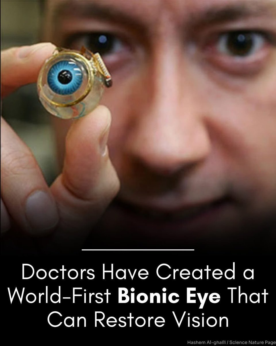 Mo Farah♿️ (@mofarah03) on Twitter photo Scientists have developed a bionic eye implant to restore vision!
Developed by <a href="/MIT/">Massachusetts Institute of Technology (MIT)</a> & Mass Eye and Ear, the tiny device helps people with blindness detect shapes, movement & obstacles. Human trials are on the way.
More: rle.mit.edu/media/pr152/29… Scientists have developed a bionic eye implant to restore vision!
Developed by <a href="/MIT/">Massachusetts Institute of Technology (MIT)</a> & Mass Eye and Ear, the tiny device helps people with blindness detect shapes, movement & obstacles. Human trials are on the way.
More: rle.mit.edu/media/pr152/29…