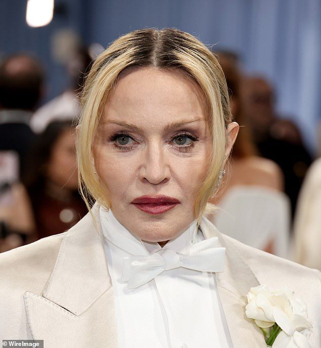 Wow, Madge looks WAY better now that her face doesn't look like it was stung by an entire beehive.