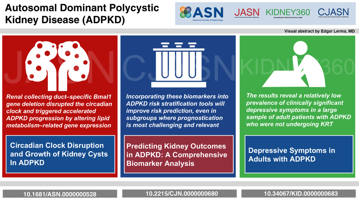 The latest @ASNPublications ASN Kidney Translation Podcast hosted by @nephro_sparks is out

Featuring ADPKD advances

🕰️ circadian clock in ADPKD in JASN
🧠 mental health in ADPKD in Kidney360
🧪 biomarkers in ADPKD in CJASN

Listen here
dts.podtrac.com/redirect.mp3/w…