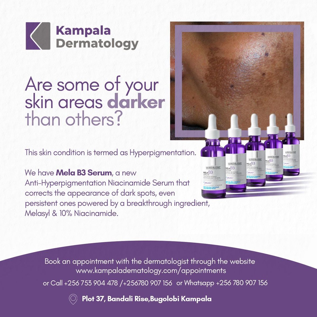 kladermatology's tweet image. Hyperpigmentation occurs when darker patches appear on the skin. Causes include age spots, melasma, and skin inflammation.

Fix this with the Mela B3 Serum which promotes skin surface renewal &amp;amp; exfoliation for a more radiant look.

#Hyperpigmentation #MelaB3Serum