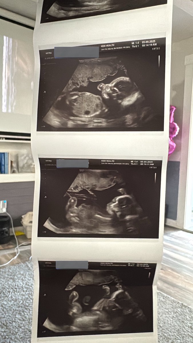 papertagss's tweet photo. Can’t wait to meet you baby girl 💕 https://t.co/OXIqmrRIOe