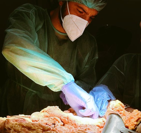 OxiliaG's tweet image. Cadaveric dissection is essential for a proper understanding of the human body and the relationships between its tissues and organs, as highlighted by the valuable insights gained from Testut’s teachings.