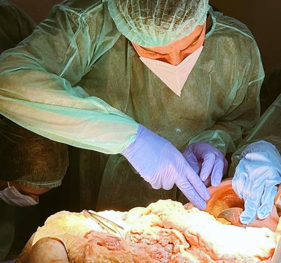 OxiliaG's tweet image. Cadaveric dissection is essential for a proper understanding of the human body and the relationships between its tissues and organs, as highlighted by the valuable insights gained from Testut’s teachings.