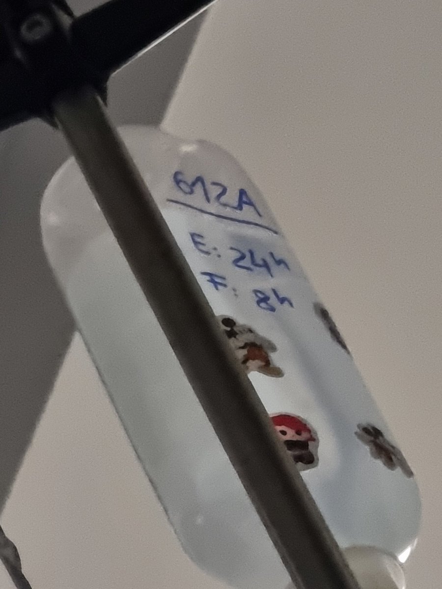 rastalandTV's tweet image. Update - its been hella rough, chemo got to me much more than I expected and I ran out of pills I used against side effects... Constant vomiting and unable to eat anything when they are giving me chemo, but its better now after being home for a week. 🙏🏾
5th chemo starts 08.05.25.