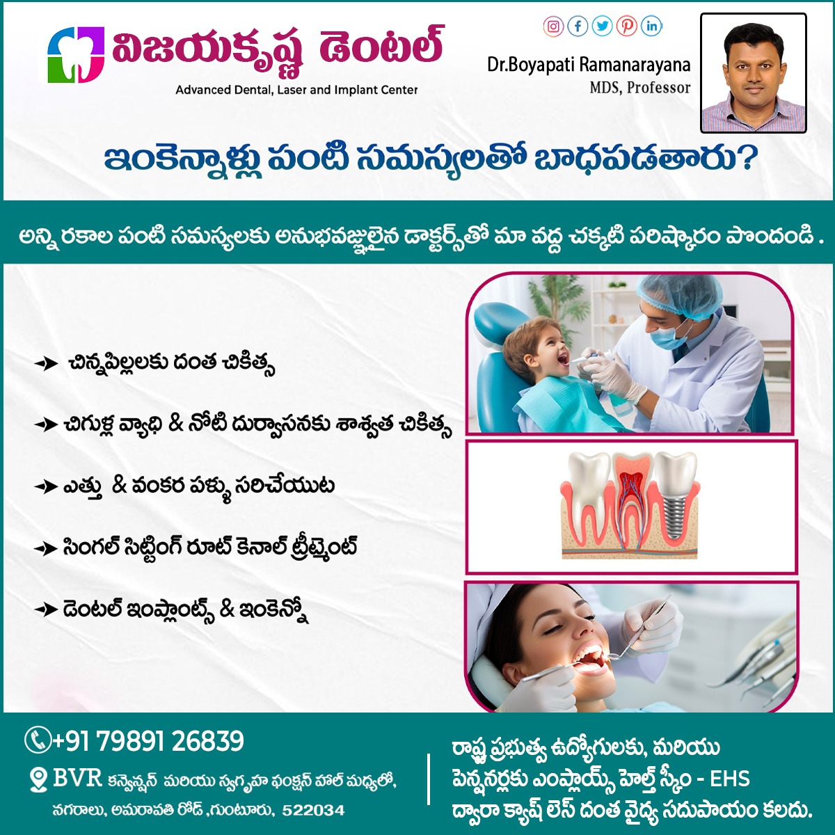 Vijayakris32331's tweet image. ఇంకెన్నాళ్లు పంటి సమస్యలతో బాధపడతారు
#bleedinggumssymptoms #fixedteeth #CrookedTeeth #throughorthodontic #rootcanal #rootcanaltreatment #drboyapatiramanarayana #besttreatment #toothreplacement #bestdentalcare #vijayakrishnadental