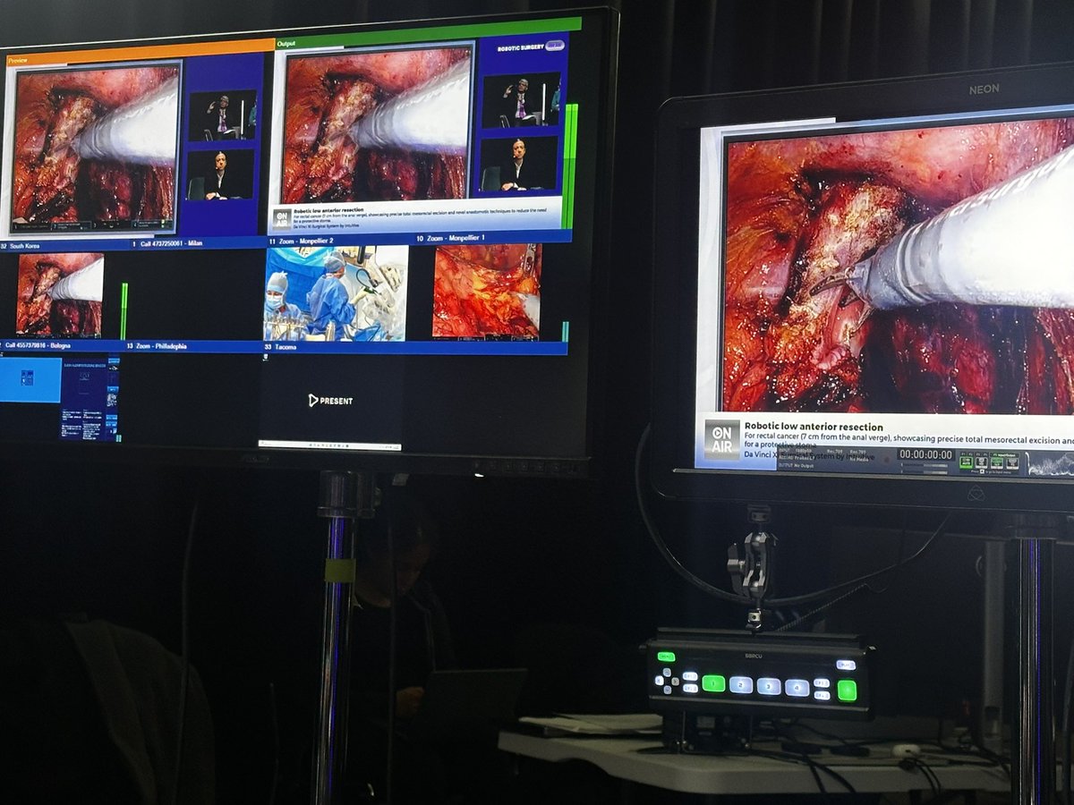 Jim Khan (@jimkhanmd) on Twitter photo Robotics surgery on Air in full flow join us great panel and superb surgeries on line. # robotics <a href="/PColorectal/">Portsmouth Colorectal</a>
robotic-surgeryonair.com Robotics surgery on Air in full flow join us great panel and superb surgeries on line. # robotics <a href="/PColorectal/">Portsmouth Colorectal</a>
robotic-surgeryonair.com
