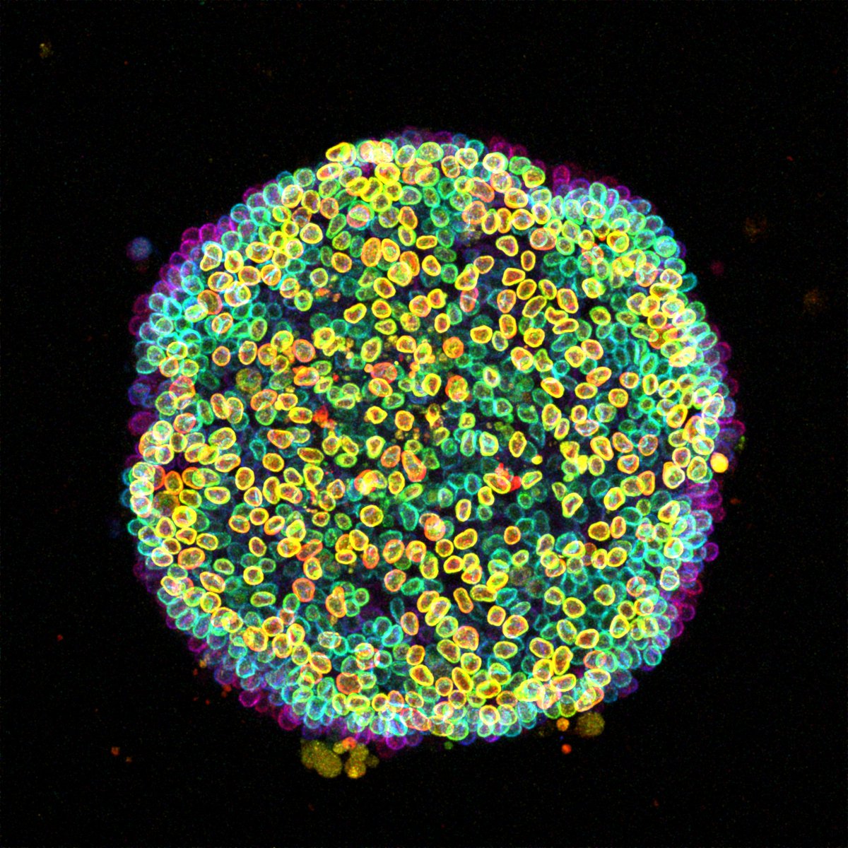 the Node (@the_node) on Twitter photo Featured image with Özge Özgüç: the Node–FocalPlane image competition
Find out more about <a href="/oozguc/">Özge Özgüç</a> and the story behind "Cell-estial bloom", which won the image competition we organised with <a href="/focalplane_jcs/">FocalPlane</a>:
thenode.biologists.com/featured-image… Featured image with Özge Özgüç: the Node–FocalPlane image competition
Find out more about <a href="/oozguc/">Özge Özgüç</a> and the story behind "Cell-estial bloom", which won the image competition we organised with <a href="/focalplane_jcs/">FocalPlane</a>:
thenode.biologists.com/featured-image…