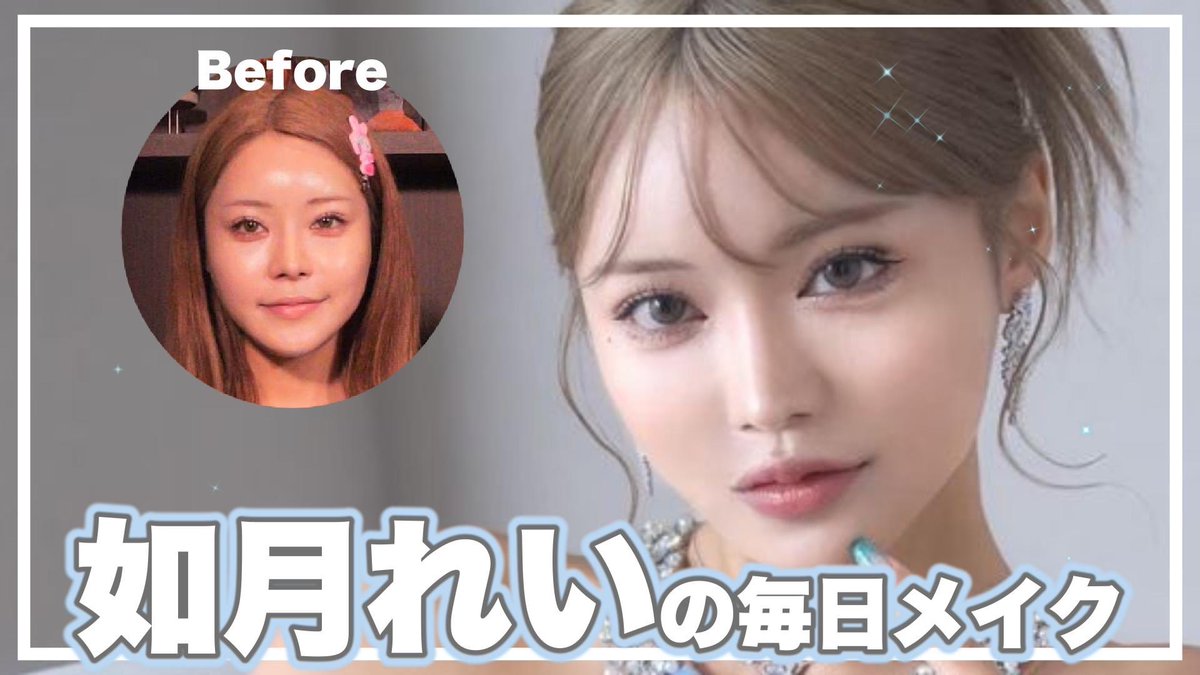 きゃ ば 嬢 整形