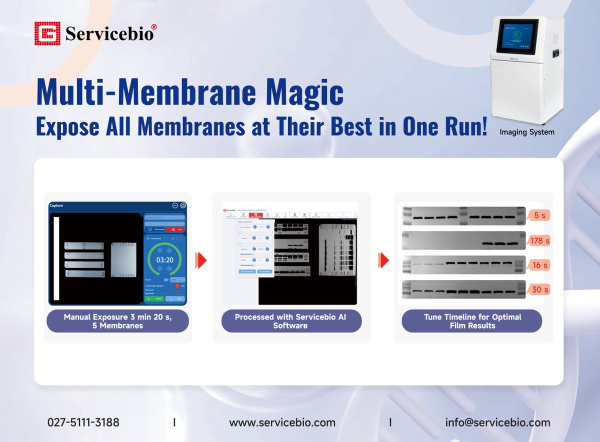 WUHANSERVICEBIO's tweet image. 5 Hidden Superpowers You Didn’t Know About Servicebio Imaging System
🔍 Superpower #4: Batch Process Membranes, Individually Perfect!
🌟Multi-membrane capture
🌟AI auto-optimizes
🌟90% time saved
Last power #5 drops next!
#WesternBlot #LabInstrument #Chemiluminescence