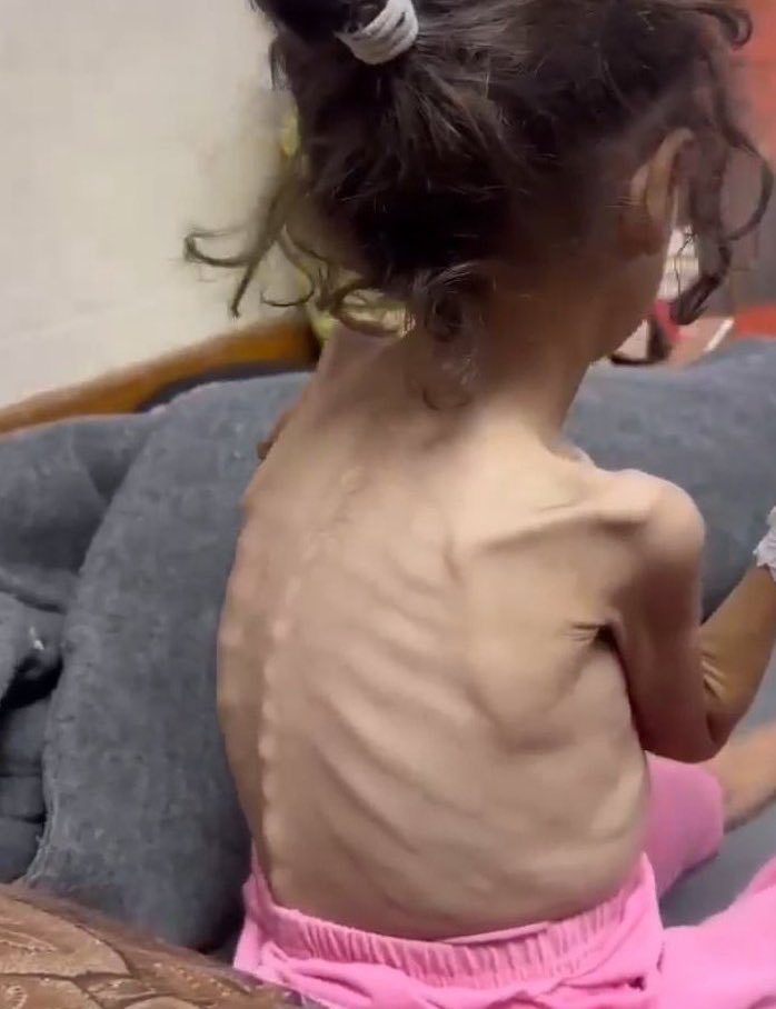 Dr. Yousef 🇵🇸 tweet media