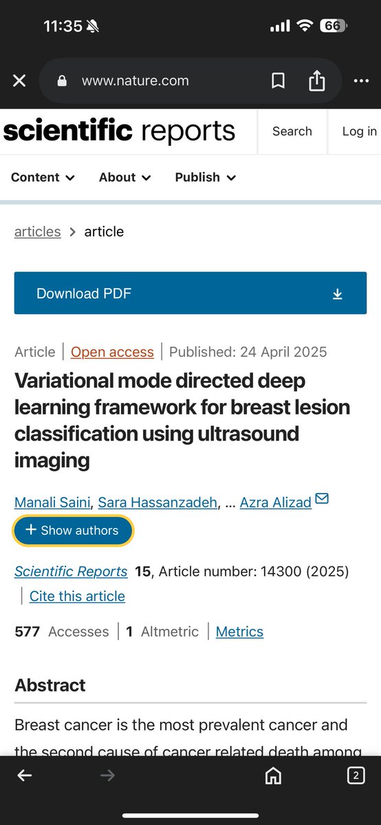 My first-year postdoc work is now published <a href="/SciReports/">Scientific Reports</a> 
We used 2D-VMD + CNN framework to classify breast lesions, no segmentation needed, with high accuracy and interpretability.
Grateful for incredible mentors and colleagues who made this possible.