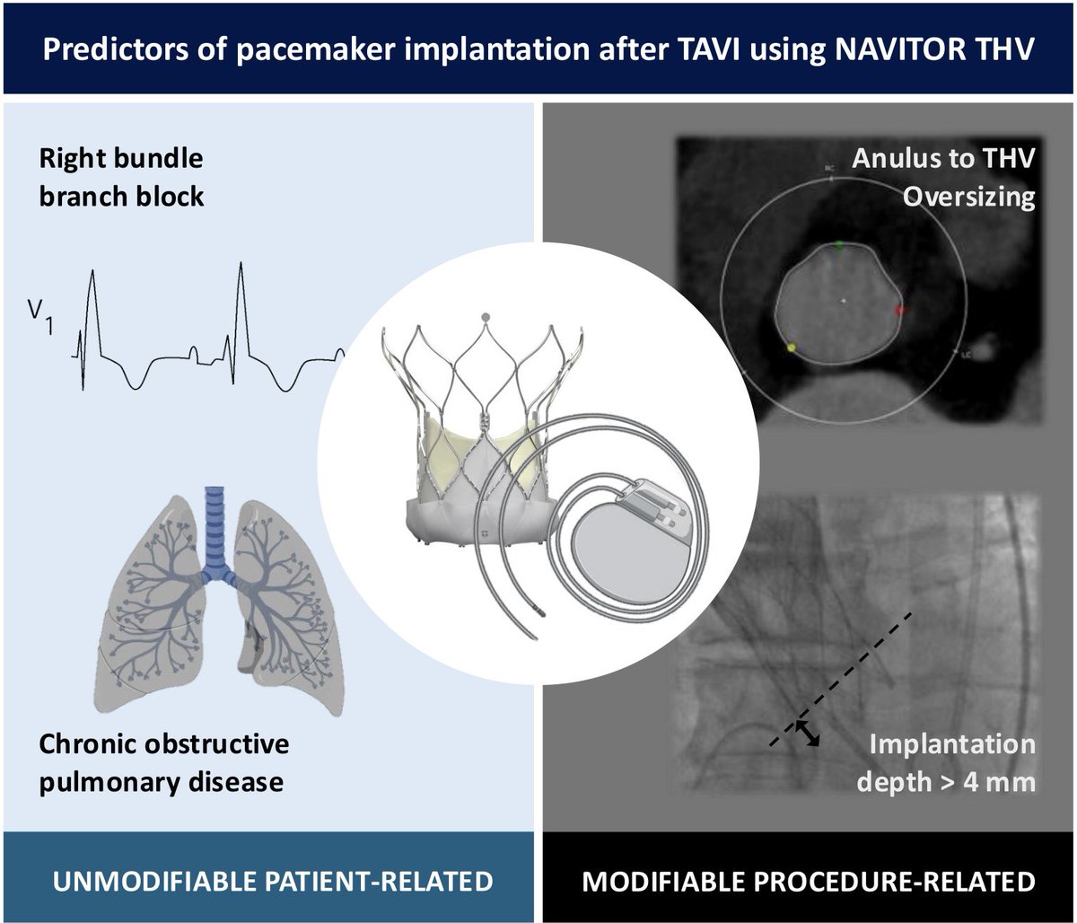🔬 New study on TAVI with Navitor THV available at: authors.elsevier.com/a/1l3075XJLHAR…

🫀 Key procedural predictors of PPI:
✔️ Implantation depth &gt;4 mm
✔️ Oversizing ≥15% (new cut-off)

📉 Excellent hemodynamics (mean gradient: 6 mmHg)

#TAVI #StructuralHeart