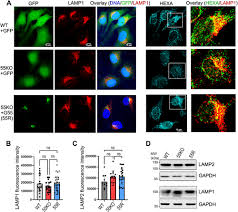 From MBoC
GRASP55 Regulates Sorting and Maturation of the Lysosomal Enzyme β-Hexosaminidase A, by Yanzhuang Wang, Hou Lab at Shenzhen Bay Laboratory, et al.

molbiolcell.org/doi/10.1091/mb… #ASCB #CellBiology