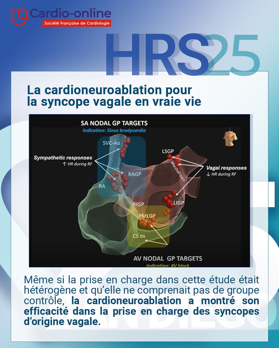 cardio-online 🫀 (@cardioonline) on Twitter photo 📢 Le groupe <a href="/rythmo_sfc/">Rythmo_SFC</a> vous propose une analyse exclusive des essais cliniques majeurs présentés lors du congrès #HRS25.
Des avancées qui redessinent les contours de la spécialité.
Leurs comptes-rendus sont à retrouver dès maintenant sur notre site 👉 cardio-online.fr/Congres/Autres… 📢 Le groupe <a href="/rythmo_sfc/">Rythmo_SFC</a> vous propose une analyse exclusive des essais cliniques majeurs présentés lors du congrès #HRS25.
Des avancées qui redessinent les contours de la spécialité.
Leurs comptes-rendus sont à retrouver dès maintenant sur notre site 👉 cardio-online.fr/Congres/Autres…