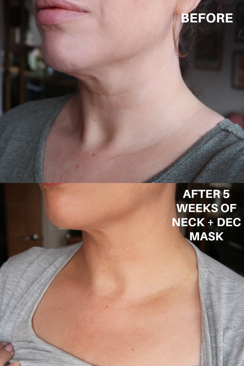 Honestly LED masks have been a game-changer to boost my skincare routine 🚀 

Just look at these results after 5 weeks from the Currentbody neck &amp; décolletage - have a read about the technology and how it works >> 

lauralouisebeauty.co.uk/led-light-ther…