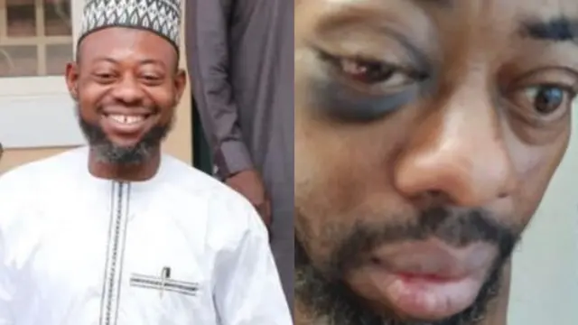 When I see Nigerians saying stuff like "There's an atmosphere of fear in Burkina Faso," I always wonder to myself, "what planet are these people living on?"

This guy is a factional president of the Nigerian Association of Nigerian Students who recently had his face broken by the