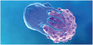 Kenar Jhaveri (@kdjhaveri) on Twitter photo May 2025 <a href="/asnpublications/">ASN Publications</a> Kidney News kidneynews.org/view/journals/… CAR-T Cell Therapy for Autoimmune Diseases Wins NephMadness 2025 <a href="/NephMadness/">NephMadness</a> <a href="/AJKDonline/">AJKD</a> <a href="/Nephro_Sparks/">Matthew Sparks, MD</a> May 2025 <a href="/asnpublications/">ASN Publications</a> Kidney News kidneynews.org/view/journals/… CAR-T Cell Therapy for Autoimmune Diseases Wins NephMadness 2025 <a href="/NephMadness/">NephMadness</a> <a href="/AJKDonline/">AJKD</a> <a href="/Nephro_Sparks/">Matthew Sparks, MD</a>
