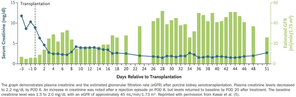 Kenar Jhaveri (@kdjhaveri) on Twitter photo May 2025 <a href="/asnpublications/">ASN Publications</a> Xenotransplantation: The Future Starts Now Aprajita Mattoo <a href="/VineetaKumar8/">Vineeta Kumar</a>
kidneynews.org/view/journals/… May 2025 <a href="/asnpublications/">ASN Publications</a> Xenotransplantation: The Future Starts Now Aprajita Mattoo <a href="/VineetaKumar8/">Vineeta Kumar</a>
kidneynews.org/view/journals/…