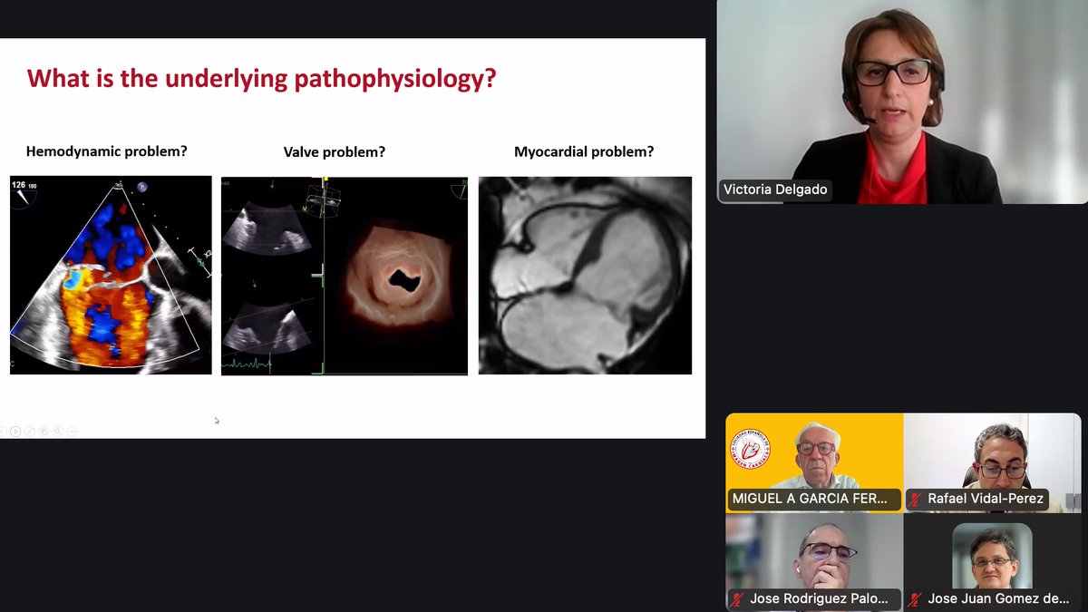 SEIC - Sociedad Española de Imagen Cardíaca (@imagencardiaca) on Twitter photo Empezando con la <a href="/VDelgadoGarcia/">Victoria Delgado</a> la sesión de Avances en Ecocardiografia clínica del Master de imagen Cardiaca de la SEIC @imagenCardiaca Empezando con la <a href="/VDelgadoGarcia/">Victoria Delgado</a> la sesión de Avances en Ecocardiografia clínica del Master de imagen Cardiaca de la SEIC @imagenCardiaca