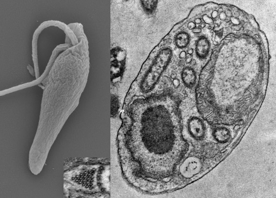JEukMicro's tweet image. We’ve published incredible #protist research in the first quarter of 2025! Julia Packer et al. describe two new species of free-living bacterivores including Novijibodo darinka pictured here. Check out the open access paper from our Jan/Feb issue. doi.org/10.1111/jeu.13…