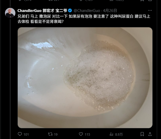 Maxwell_GDA's tweet photo. 这麻烦了，我跟宝二爷的对比了一下，我这个好像也有问题了，奶奶的，难道炒币的人都这个宿命嘛？ https://t.co/5lIMdKKOiu